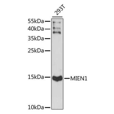 Western Blot - Anti-XTP4 Antibody (A88379) - Antibodies.com