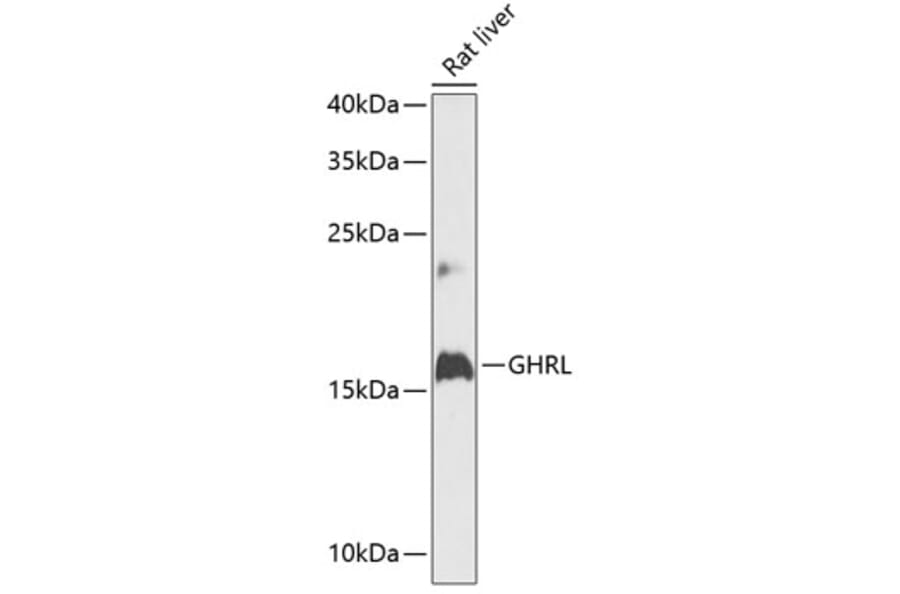 Western Blot - Anti-Ghrelin Antibody (A88380) - Antibodies.com