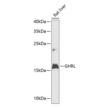 Western Blot - Anti-Ghrelin Antibody (A88380) - Antibodies.com