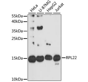 Western Blot - Anti-RPL22 Antibody (A88381) - Antibodies.com