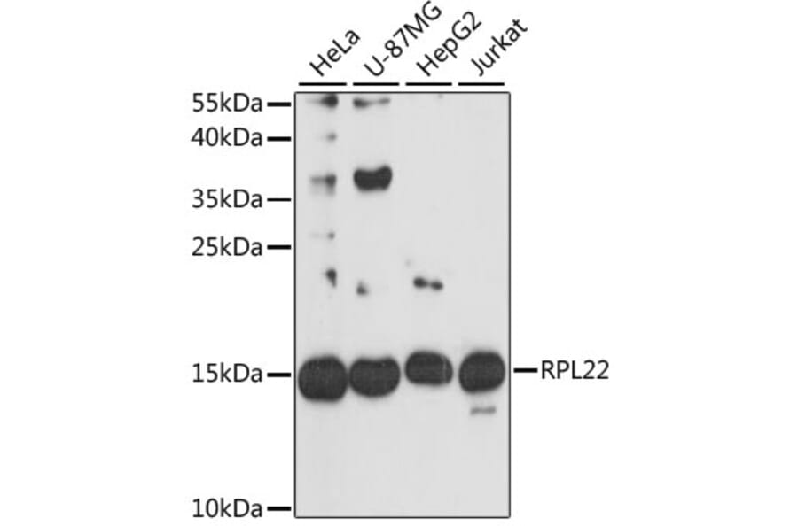 Western Blot - Anti-RPL22 Antibody (A88381) - Antibodies.com