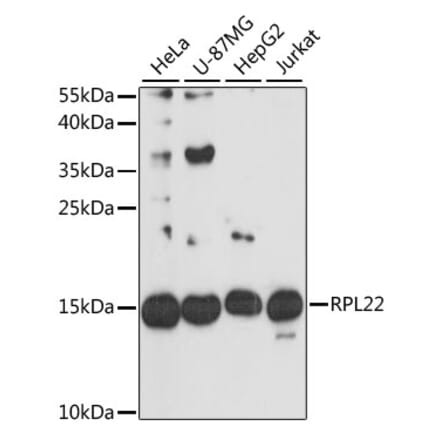 Western Blot - Anti-RPL22 Antibody (A88381) - Antibodies.com