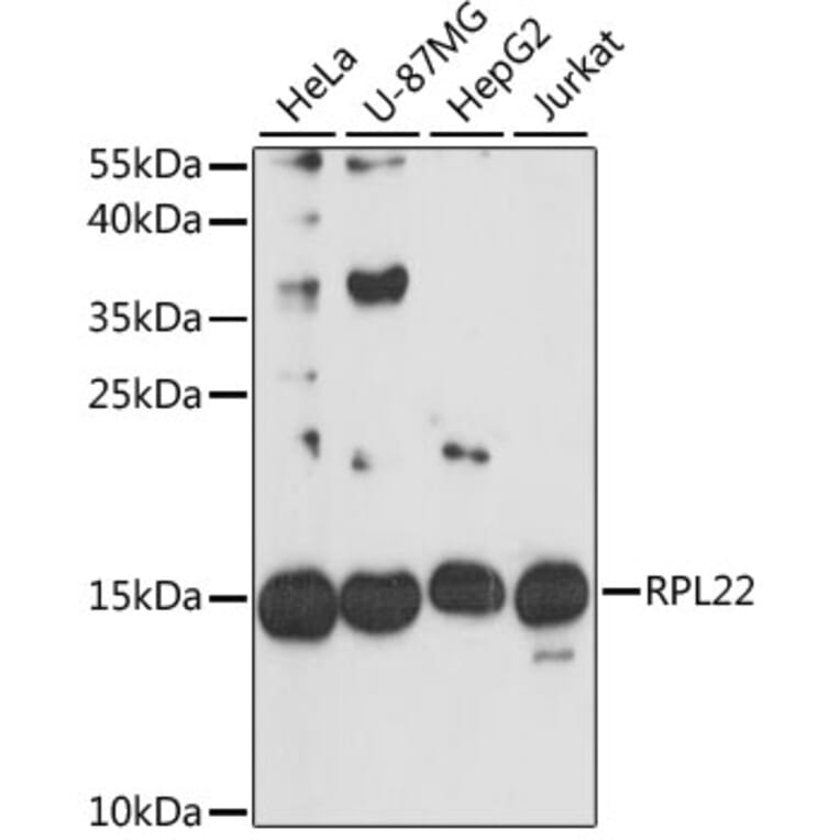 Western Blot - Anti-RPL22 Antibody (A88381) - Antibodies.com