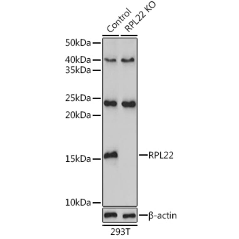 Western Blot - Anti-RPL22 Antibody (A88381) - Antibodies.com