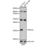 Western Blot - Anti-RPL22 Antibody (A88381) - Antibodies.com