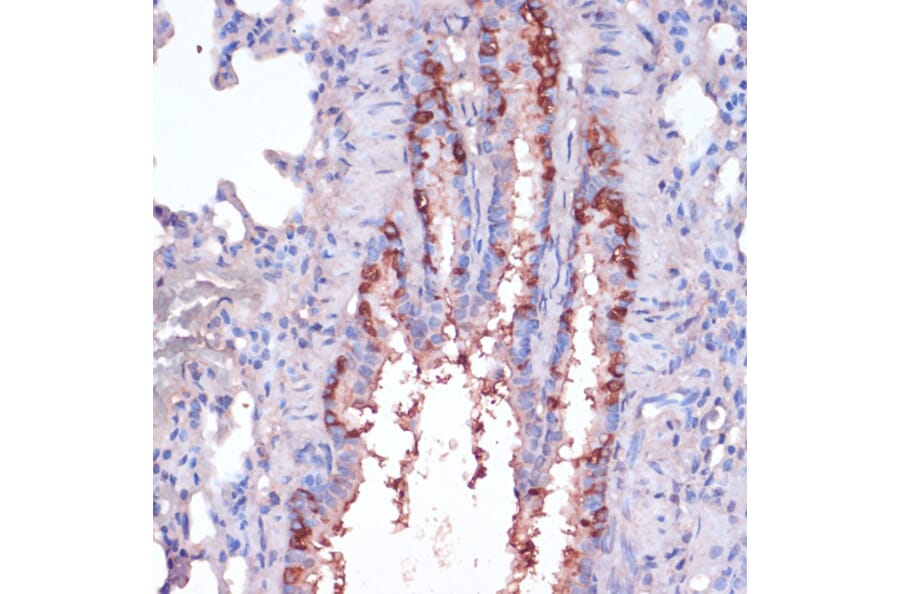 Immunohistochemistry - Anti-RPL22 Antibody (A88381) - Antibodies.com