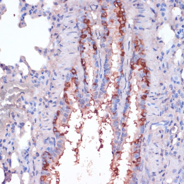 Immunohistochemistry - Anti-RPL22 Antibody (A88381) - Antibodies.com