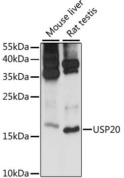 Western blot analysis of extracts of various cell lines, using Anti-MRPS14 Antibody (A15499) at 1:1,000 dilution.
Secondary antibody: Goat Anti-Rabbit IgG (H+L) (HRP) (AS014) at 1:10,000 dilution.
Lysates / proteins: 25µg per lane.
Blocking buffer: 3% non-fat dry milk in TBST.
Detection: ECL Basic Kit (RM00020).
Exposure time: 30s.