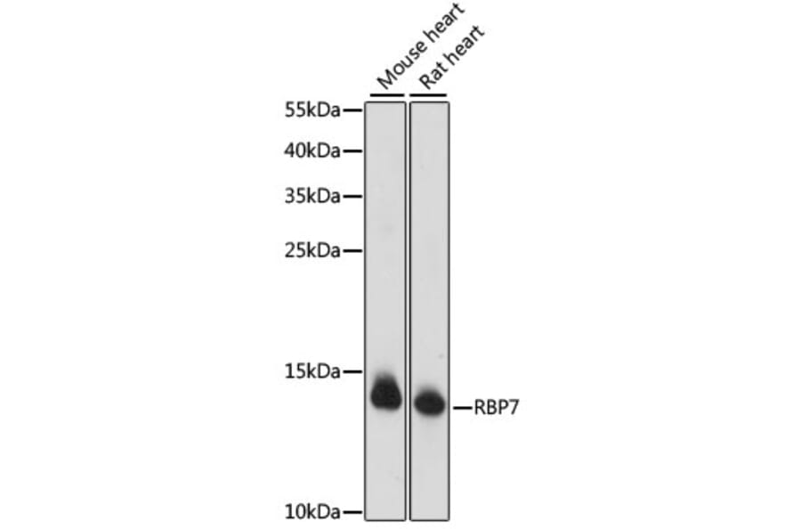 Western Blot - Anti-RBP7 Antibody (A88384) - Antibodies.com