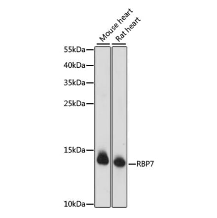 Western Blot - Anti-RBP7 Antibody (A88384) - Antibodies.com