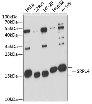 Western blot analysis of extracts of various cell lines, using Anti-SRP14 Antibody (A12926) at 1:3000 dilution.
Secondary antibody: Goat Anti-Rabbit IgG (H+L) (HRP) (AS014) at 1:10,000 dilution.
Lysates / proteins: 25µg per lane.
Blocking buffer: 3% non-fat dry milk in TBST.
Detection: ECL Basic Kit (RM00020).
Exposure time: 90s.