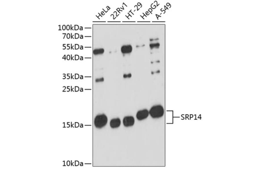 Western Blot - Anti-SRP14 Antibody (A88385) - Antibodies.com