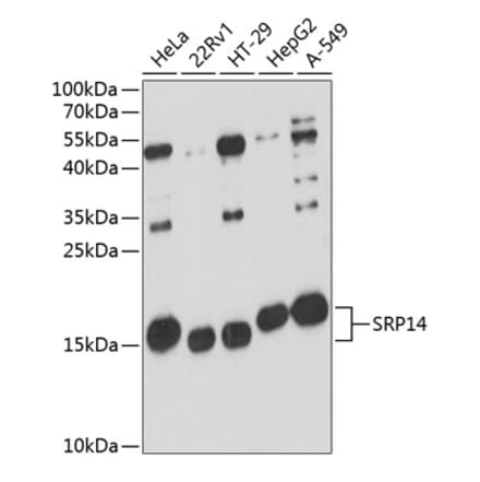 Western Blot - Anti-SRP14 Antibody (A88385) - Antibodies.com