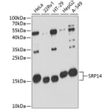 Western Blot - Anti-SRP14 Antibody (A88385) - Antibodies.com