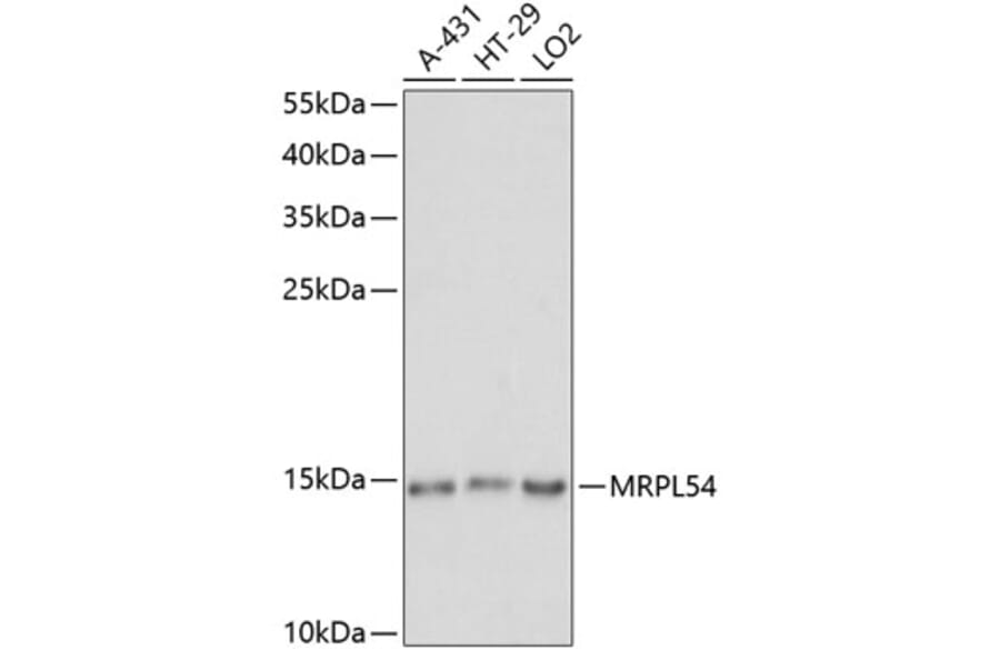 Western Blot - Anti-MRPL54 Antibody (A88386) - Antibodies.com