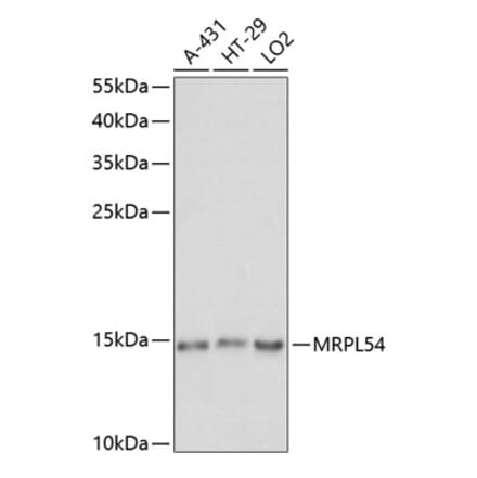 Western Blot - Anti-MRPL54 Antibody (A88386) - Antibodies.com
