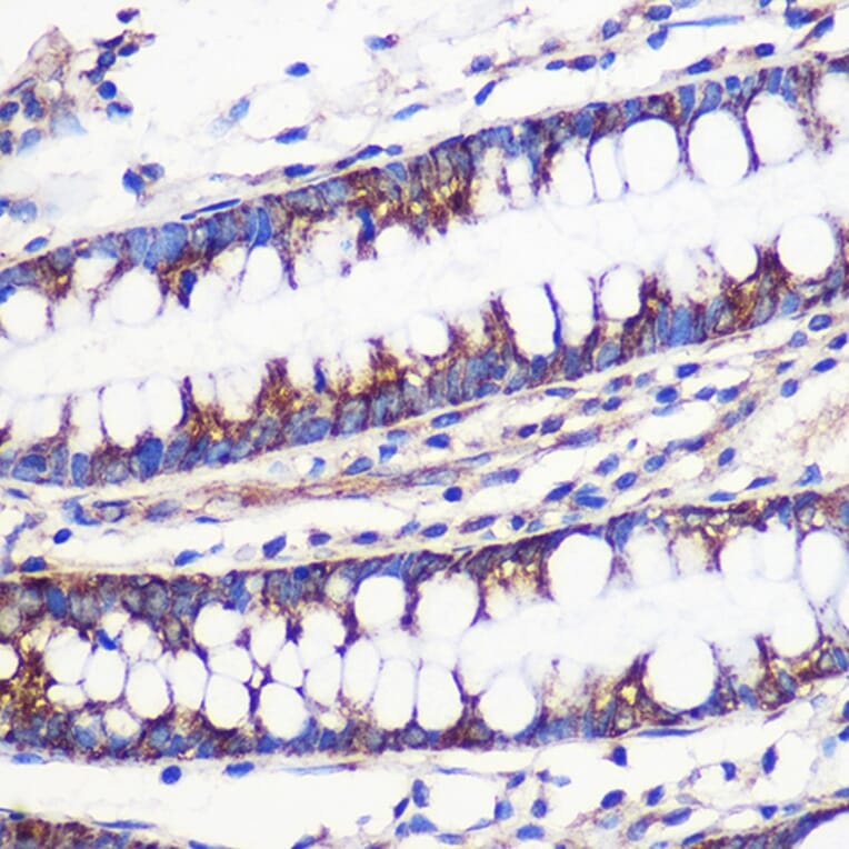 Immunohistochemistry - Anti-MRPL54 Antibody (A88386) - Antibodies.com