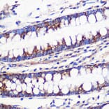 Immunohistochemistry - Anti-MRPL54 Antibody (A88386) - Antibodies.com