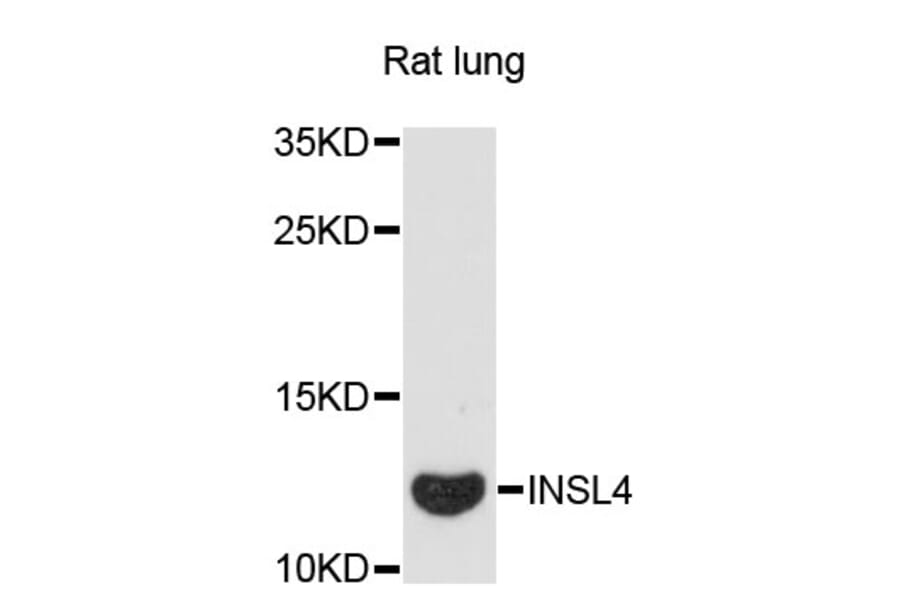 Western Blot - Anti-INSL4 Antibody (A13025) - Antibodies.com