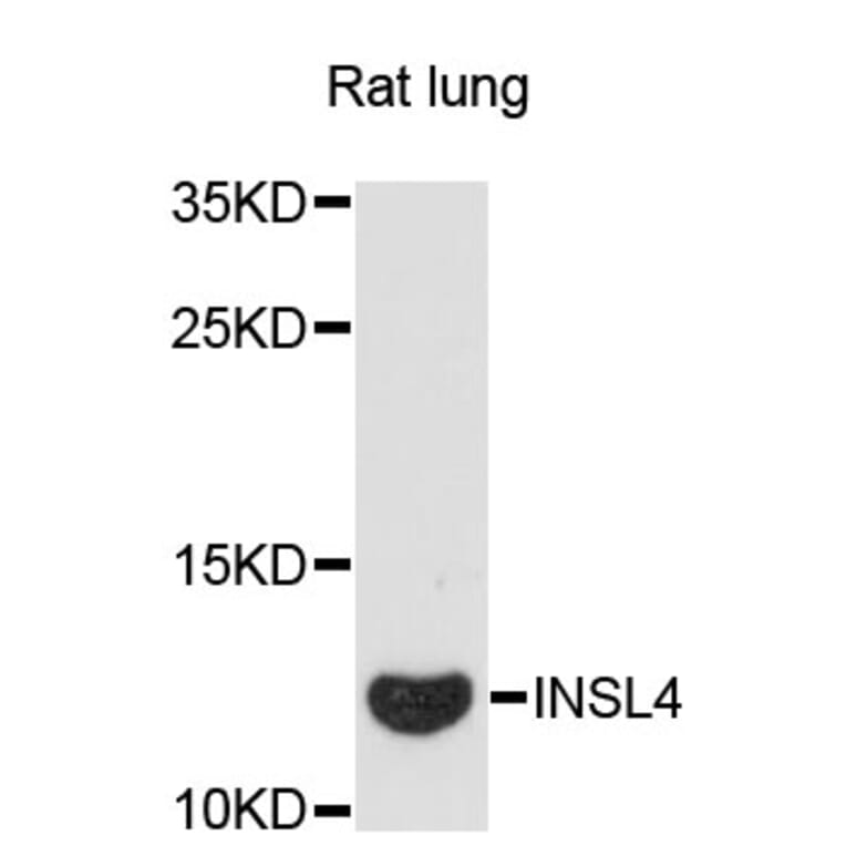 Western Blot - Anti-INSL4 Antibody (A13025) - Antibodies.com