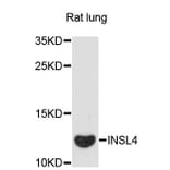 Western Blot - Anti-INSL4 Antibody (A13025) - Antibodies.com