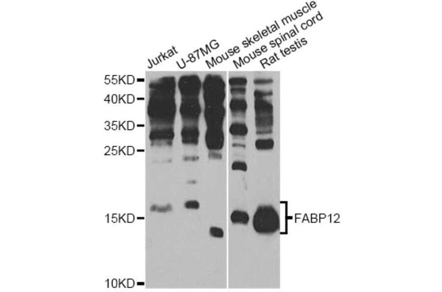 Western Blot - Anti-FABP12 Antibody (A12620) - Antibodies.com