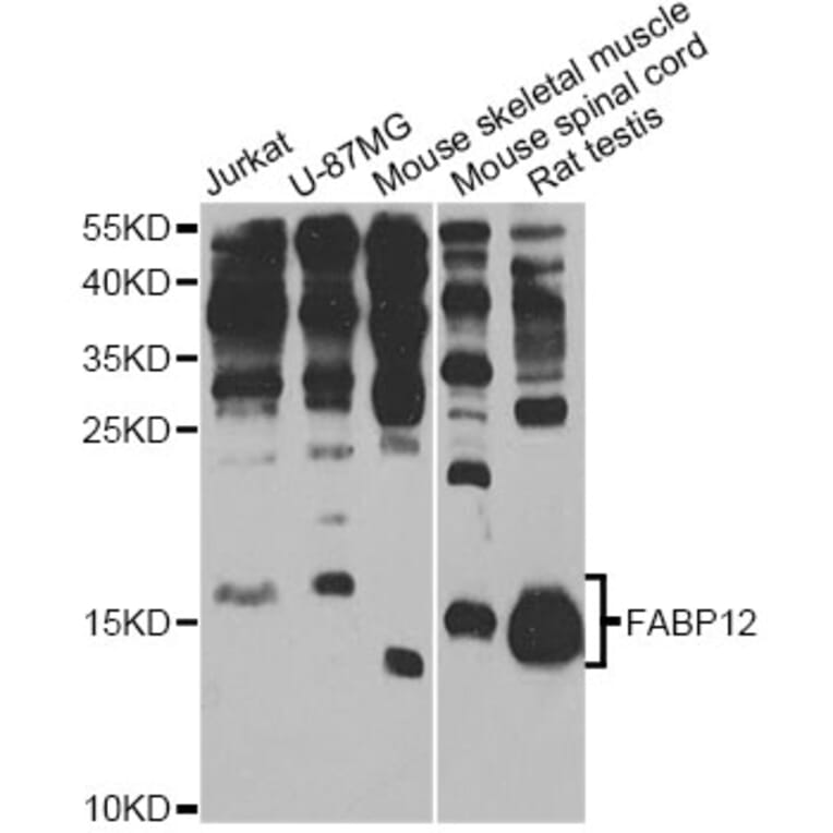 Western Blot - Anti-FABP12 Antibody (A12620) - Antibodies.com