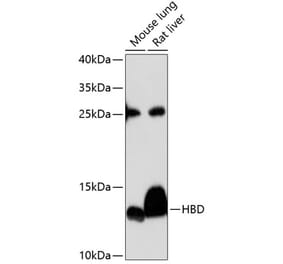 Western Blot - Anti-HBD Antibody (A88389) - Antibodies.com