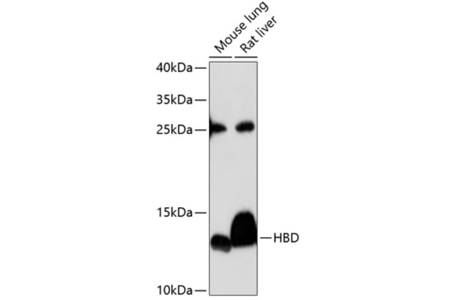 Western Blot - Anti-HBD Antibody (A88389) - Antibodies.com