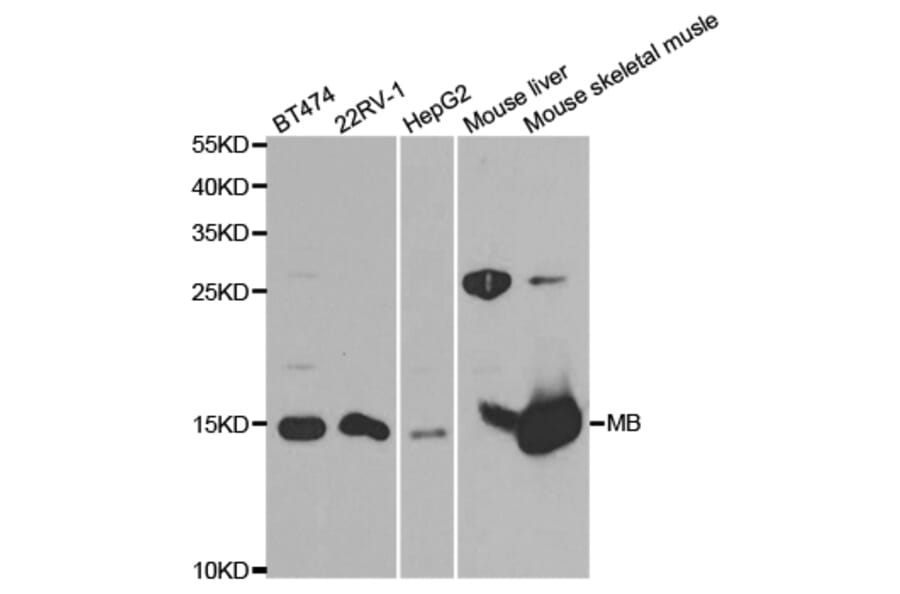 Western Blot - Anti-MB Antibody (A13326) - Antibodies.com