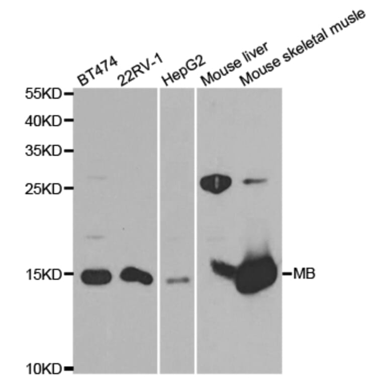 Western Blot - Anti-MB Antibody (A13326) - Antibodies.com