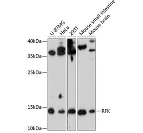 Western Blot - Anti-RFK Antibody (A88391) - Antibodies.com