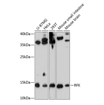 Western Blot - Anti-RFK Antibody (A88391) - Antibodies.com