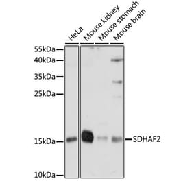 Western Blot - Anti-SDHAF2 Antibody (A88392) - Antibodies.com