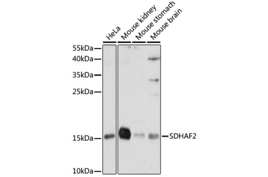Western Blot - Anti-SDHAF2 Antibody (A88392) - Antibodies.com