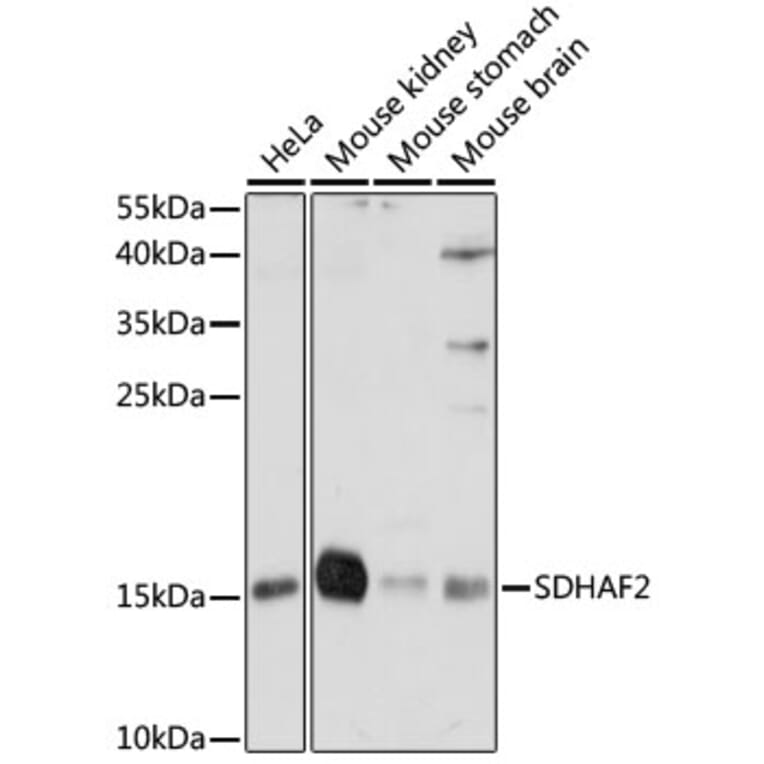 Western Blot - Anti-SDHAF2 Antibody (A88392) - Antibodies.com