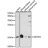 Western Blot - Anti-SDHAF2 Antibody (A88392) - Antibodies.com