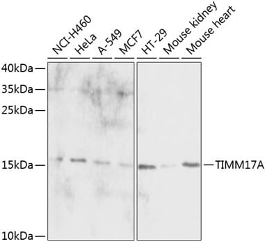 Western blot analysis of extracts of various cell lines, using Anti-TIMM17A Antibody (A13578) at 1:1,000 dilution.
Secondary antibody: Goat Anti-Rabbit IgG (H+L) (HRP) (AS014) at 1:10,000 dilution.
Lysates / proteins: 25µg per lane.
Blocking buffer: 3% non-fat dry milk in TBST.
Detection: ECL Enhanced Kit (RM00021).
Exposure time: 30s.