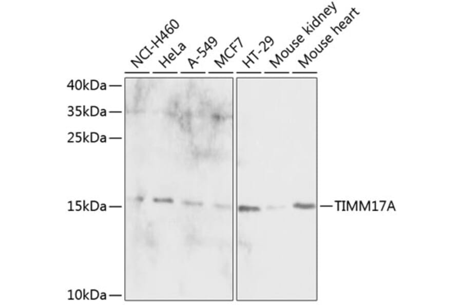 Western Blot - Anti-TIMM17A / TIM17 Antibody (A88393) - Antibodies.com