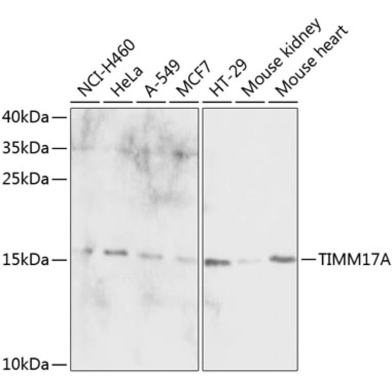 Western Blot - Anti-TIMM17A / TIM17 Antibody (A88393) - Antibodies.com