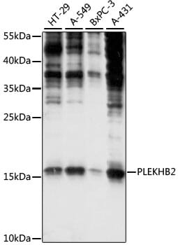 Western blot analysis of extracts of various cell lines, using Anti-PLEKHB2 Antibody (A15462) at 1:1,000 dilution.
Secondary antibody: Goat Anti-Rabbit IgG (H+L) (HRP) (AS014) at 1:10,000 dilution.
Lysates / proteins: 25µg per lane.
Blocking buffer: 3% non-fat dry milk in TBST.
Detection: ECL Basic Kit (RM00020).
Exposure time: 30s.
