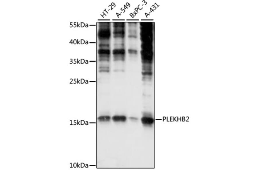 Western Blot - Anti-PLEKHB2 Antibody (A88394) - Antibodies.com