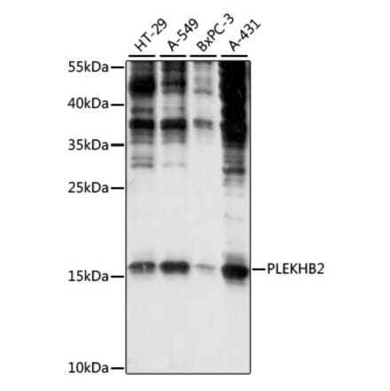 Western Blot - Anti-PLEKHB2 Antibody (A88394) - Antibodies.com