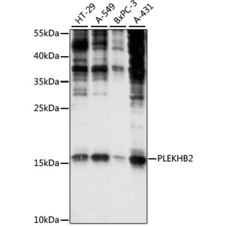 Western Blot - Anti-PLEKHB2 Antibody (A88394) - Antibodies.com