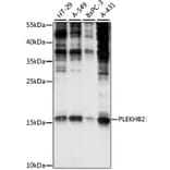 Western Blot - Anti-PLEKHB2 Antibody (A88394) - Antibodies.com