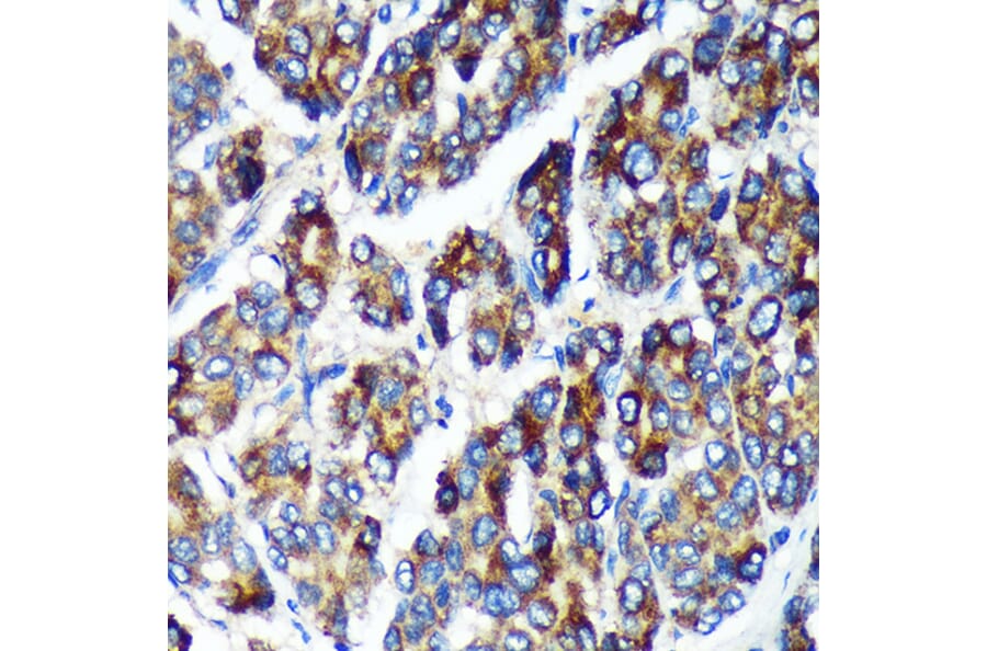 Immunohistochemistry - Anti-PLEKHB2 Antibody (A88394) - Antibodies.com