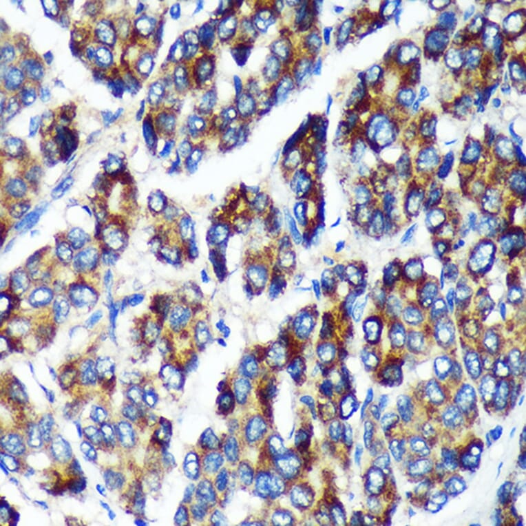 Immunohistochemistry - Anti-PLEKHB2 Antibody (A88394) - Antibodies.com