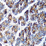 Immunohistochemistry - Anti-PLEKHB2 Antibody (A88394) - Antibodies.com