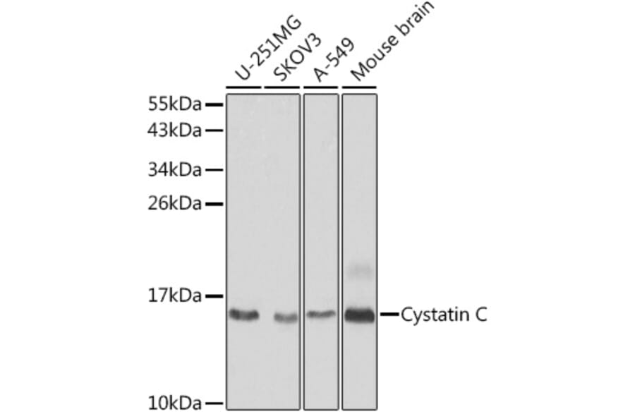 Western Blot - Anti-Cystatin C Antibody (A88396) - Antibodies.com