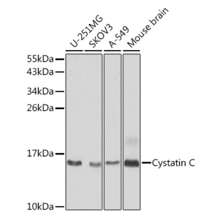Western Blot - Anti-Cystatin C Antibody (A88396) - Antibodies.com